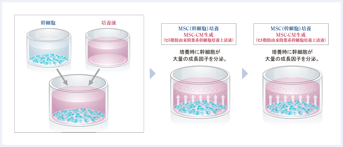 MSC-CM（ヒト脂肪由来間葉系幹細胞培養上清液）とは