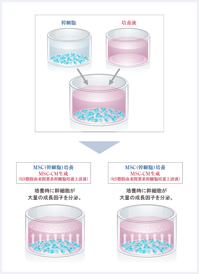 MSC-CM（ヒト脂肪由来間葉系幹細胞培養上清液）とは